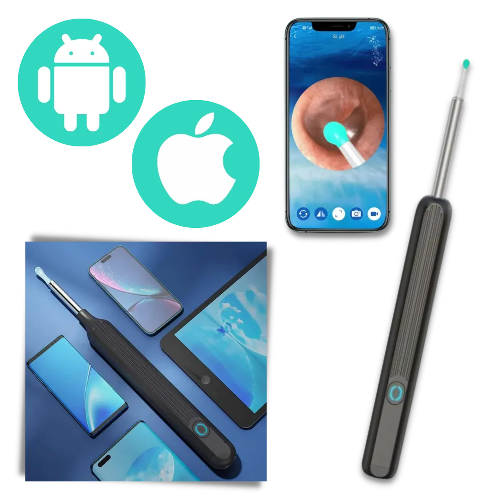 Smart Ear Wax Removal Camera