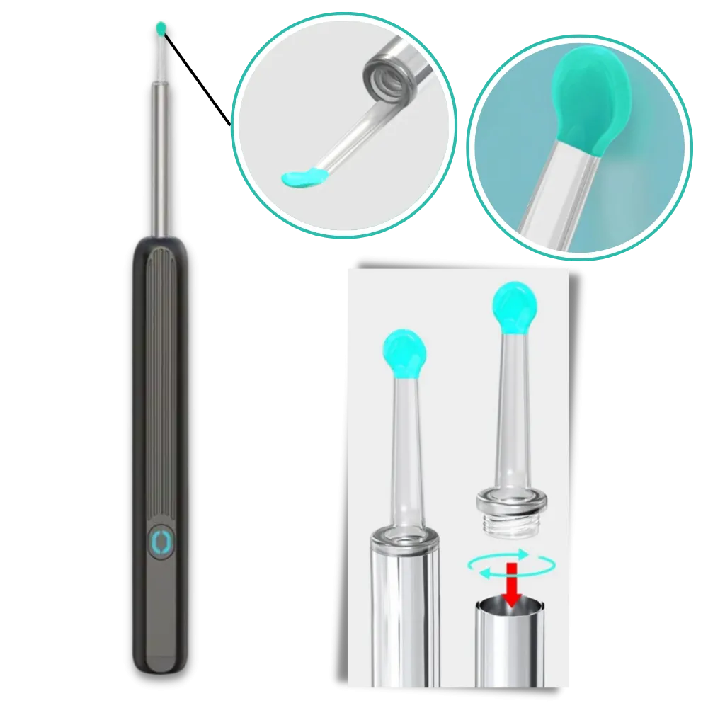 Smart Ear Wax Removal Camera